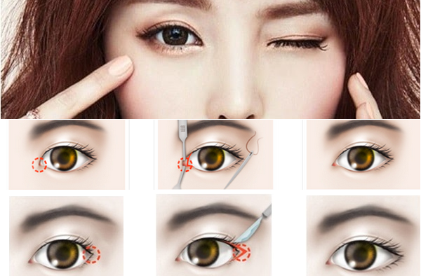 Review tất tần tật những phương pháp làm đẹp mắt đang gây bão giúp chị em sở hữu mắt đẹp tròn long lanh - Ảnh 4. Review tất tần tật những phương pháp làm đẹp mắt đang gây bão giúp chị em sở hữu mắt đẹp tròn long lanh - Ảnh 4.