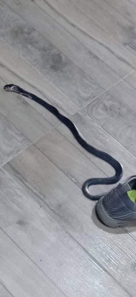 Bị rắn độc cắn khi lấy giày để mang, một cậu bé đã phải nhập viện gấp với bàn tay sưng húp, tím bầm - Ảnh 3.