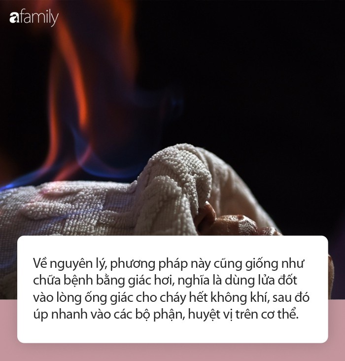 Đốt lửa lên mặt làm đẹp da khiến nhiều người tá hỏa thực chất là phương pháp làm đẹp thế nào? - Ảnh 3.