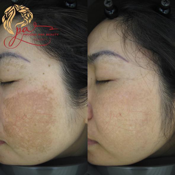 Hạnh ph&uacute;c nhờ hết n&aacute;m - Ảnh 5.