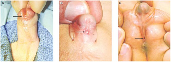 Liên giới tính: Những sự thật được hé lộ gây sốc (P1) - Ảnh 4.