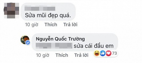 Sau Việt Anh, Quốc Trường vướng nghi án phẫu thuật thẩm mỹ vì chiếc mũi - Ảnh 4.