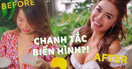 Hành trình nâng ngực từ &quot;chanh hóa bưởi&quot; của beauty blogger xinh đẹp từng ấp ủ tới 10 năm - Ảnh 2.