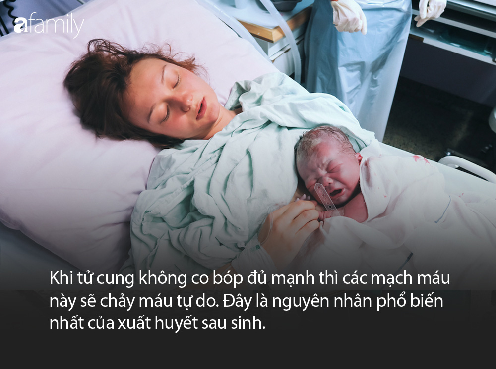 Vừa sinh con được 5 tiếng, bà mẹ đã xuống giường đi lại, bác sĩ mắng 1 trận té tát - Ảnh 3. Vừa sinh con được 5 tiếng, bà mẹ đã xuống giường đi lại, bác sĩ mắng 1 trận té tát - Ảnh 3.