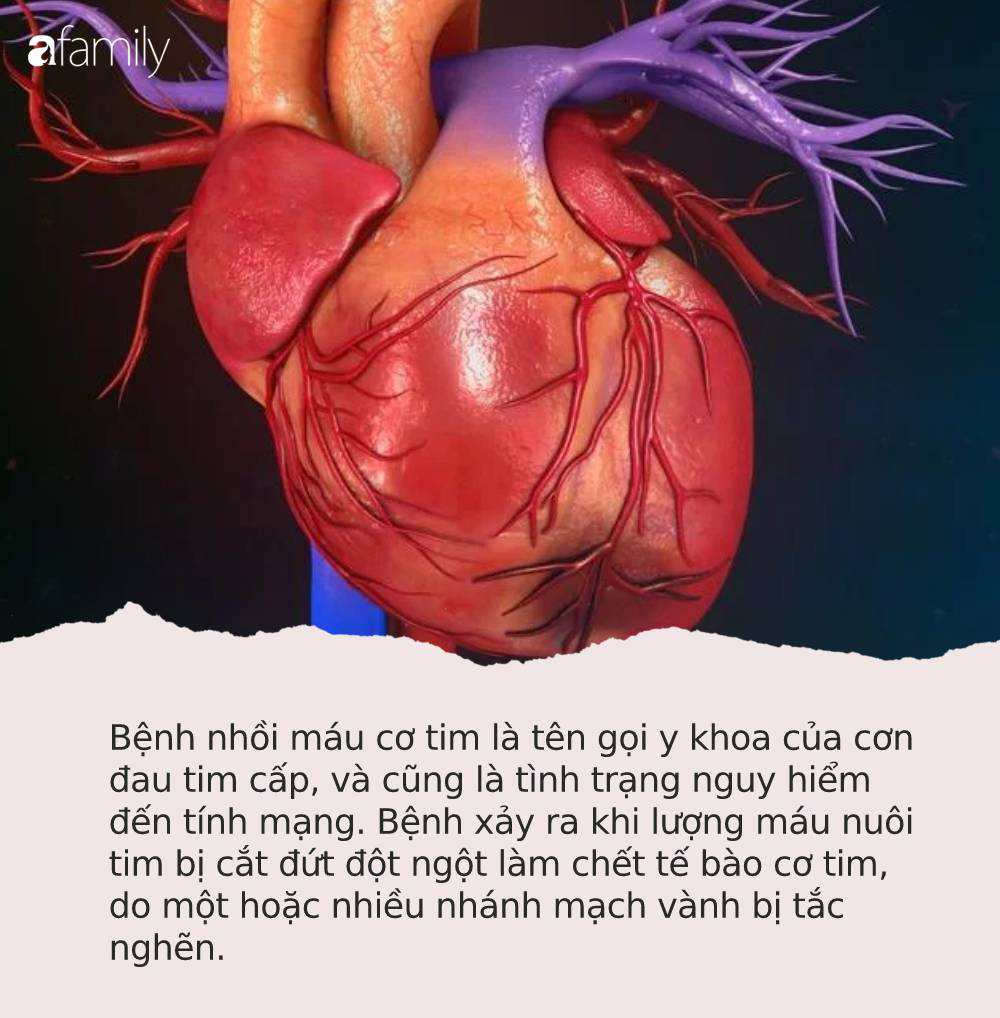 4 cơn đau ở vị trí “không liên quan” lại là dấu hiệu sớm cảnh báo nhồi máu cơ tim, hãy nhận biết để vượt qua cửa tử - Ảnh 1.