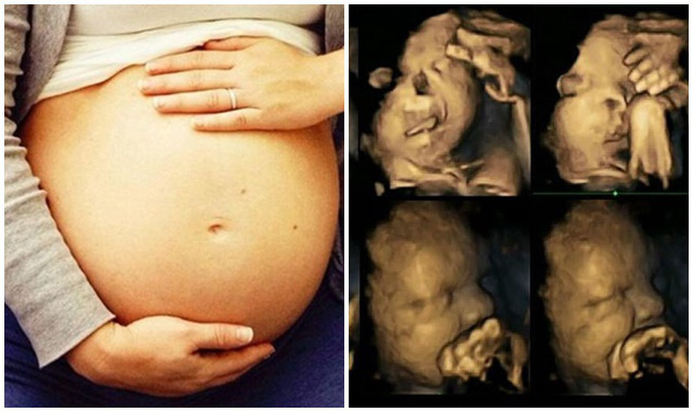 Cảnh báo các bà mẹ: Hóa chất có thể làm tăng nguy cơ con cái sinh ra bị dị tật bẩm sinh - Ảnh 2.