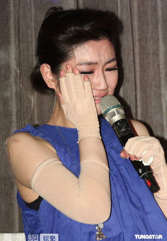 Những nghề nghiệp của giới nghệ sĩ: Cao Dĩ Tường đột tử, Selina (S.H.E) cháy phỏng mặt, Onew (SHINee) suýt mất mạng - Ảnh 9. Những nghề nghiệp của giới nghệ sĩ: Cao Dĩ Tường đột tử, Selina (S.H.E) cháy phỏng mặt, Onew (SHINee) suýt mất mạng - Ảnh 9.