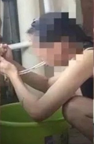 Học mẹo giảm cân gây sốt MXH Trung Quốc, cô gái vô tình nuốt chửng ống nhựa dài 30cm - Ảnh 1.