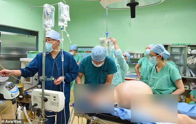 Tưởng mang đa thai, người phụ nữ kinh hãi khi bác sĩ lôi một khối u bướu to lù lù nặng đến 35kg ra khỏi cơ thể - Ảnh 4.