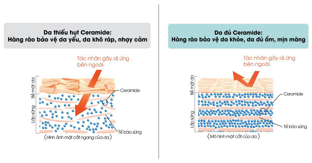 Hội thảo Curél 2019 cùng chia sẻ thông tin về Ceramide – Bí quyết cho làn da nhạy cảm - Ảnh 1. Hội thảo Curél 2019 cùng chia sẻ thông tin về Ceramide – Bí quyết cho làn da nhạy cảm - Ảnh 1.
