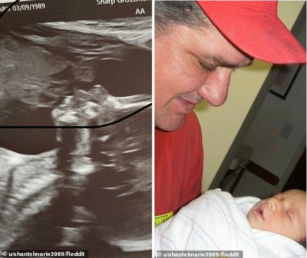 Siêu âm thai ở tuần 19, cả bố và mẹ đều tròn mắt ngạc nhiên khi bác sĩ chụp được ảnh này của con - Ảnh 6.