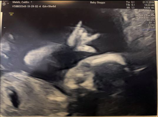Siêu âm thai ở tuần 19, cả bố và mẹ đều tròn mắt ngạc nhiên khi bác sĩ chụp được ảnh này của con - Ảnh 2.