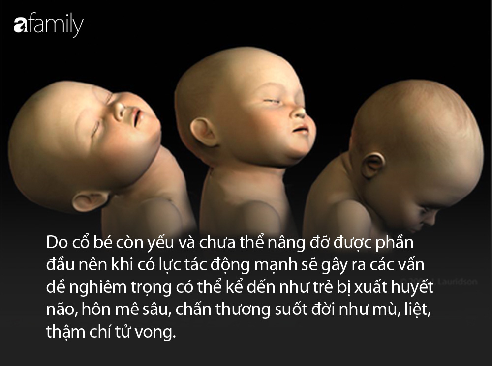 Bé 5 tháng tuổi trải qua 3 cơn đau tim, 2 lần đột quỵ trước khi tử vong do bố vô ý rung lắc trẻ - Ảnh 1. Bé gái 9 tháng tuổi trải qua 3 cơn đau tim, 2 lần đột quỵ trước khi tử vong do bố mẹ vô ý làm một việc - Ảnh 1.