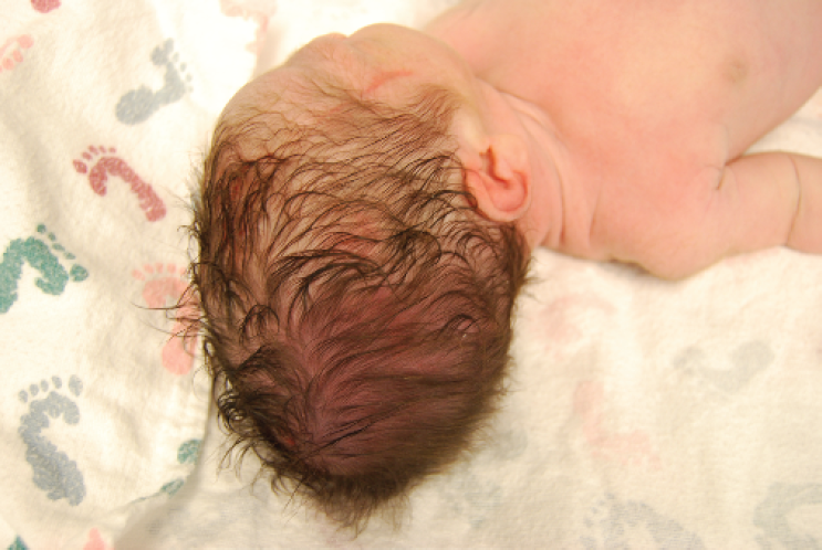 Những đặc điểm ở trẻ sơ sinh khiến nhiều cha mẹ ngạc nhi&ecirc;n v&igrave; kh&aacute;c xa tưởng tượng - Ảnh 5.