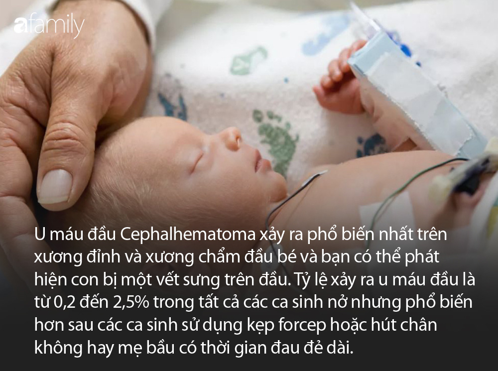 Những đặc điểm ở trẻ sơ sinh khiến nhiều cha mẹ ngạc nhi&ecirc;n v&igrave; kh&aacute;c xa tưởng tượng - Ảnh 9.