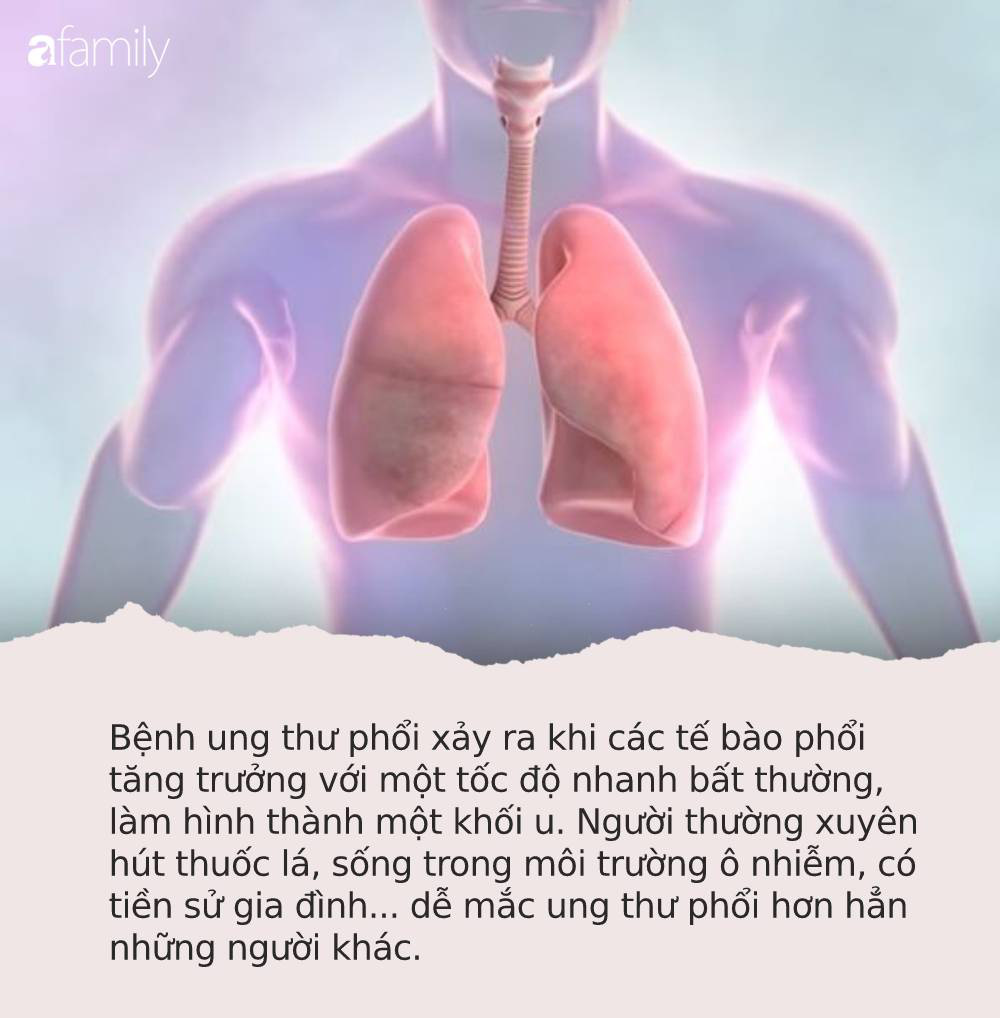 Tế bào ung thư phổi thường bị “kích thích” khi gặp 4 kiểu người này: Nếu có tên, bạn cũng nên đi khám sớm - Ảnh 1.