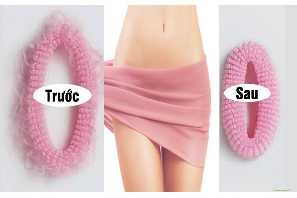 Sốt rần rần với phương pháp trẻ hóa âm đạo mà không gây đau đớn, xem quy trình lại càng thấy hứng thú - Ảnh 1. Sốt rần rần với phương pháp trẻ hóa âm đạo mà không gây đau đớn, xem quy trình lại càng thấy hứng thú - Ảnh 1.