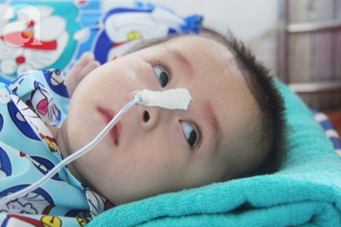 Hơn 1,2 tỷ đồng giúp đỡ bé trai 7 tháng tuổi bại não, bị mẹ bỏ rơi trước cổng chùa sang Singapore chữa trị - Ảnh 1.