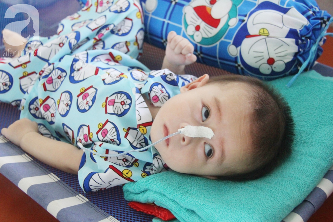 Hơn 1,2 tỷ đồng giúp đỡ bé trai 7 tháng tuổi bại não, bị mẹ bỏ rơi trước cổng chùa sang Singapore chữa trị - Ảnh 2. Hơn 1,2 tỷ đồng giúp đỡ bé trai 7 tháng tuổi bại não, bị mẹ bỏ rơi trước cổng chùa sang Singapore chữa trị - Ảnh 2.