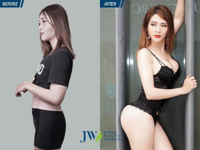 Khi đ&agrave;n &ocirc;ng n&acirc;ng ngực, n&acirc;ng m&ocirc;ng để th&agrave;nh phụ nữ - Ảnh 4.