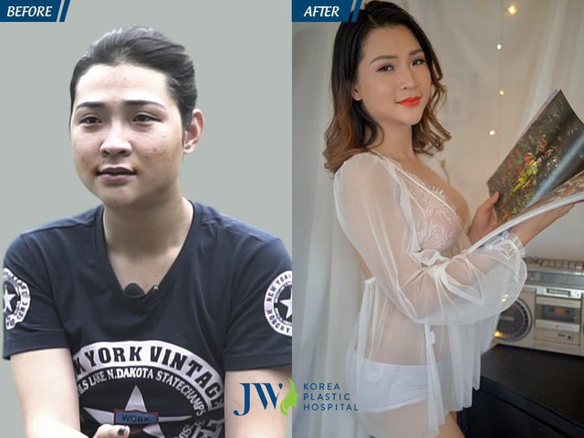 Khi đ&agrave;n &ocirc;ng n&acirc;ng ngực, n&acirc;ng m&ocirc;ng để th&agrave;nh phụ nữ - Ảnh 5.
