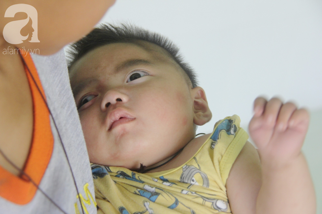 Cái Tết đầu tiên của bé Trọng Em 9 tháng tuổi bị mẹ bỏ rơi khi phát hiện bé bị bại não - Ảnh 12.