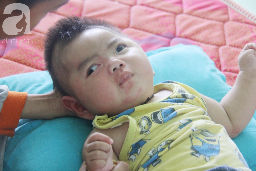 Cái Tết đầu tiên của bé Trọng Em 9 tháng tuổi bị mẹ bỏ rơi khi phát hiện bé bị bại não - Ảnh 15.