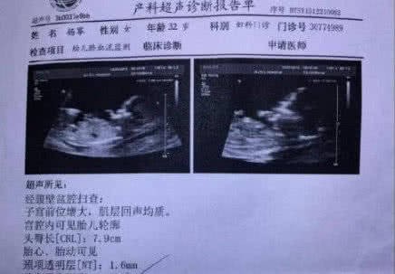 Xôn xao thông tin Dương Mịch đang mang thai sau 3 tháng ly hôn, bố đứa trẻ là diễn viên nổi tiếng  - Ảnh 2.