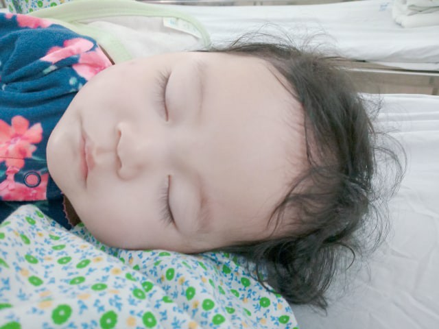 Em bé Hà Nội bị bà giúp việc đắp tỏi để chữa ho, nào ngờ hậu quả đau lòng lại xảy ra khiến bé bỏng nặng, nhập viện gần 2 tuần mới khỏi - Ảnh 4.