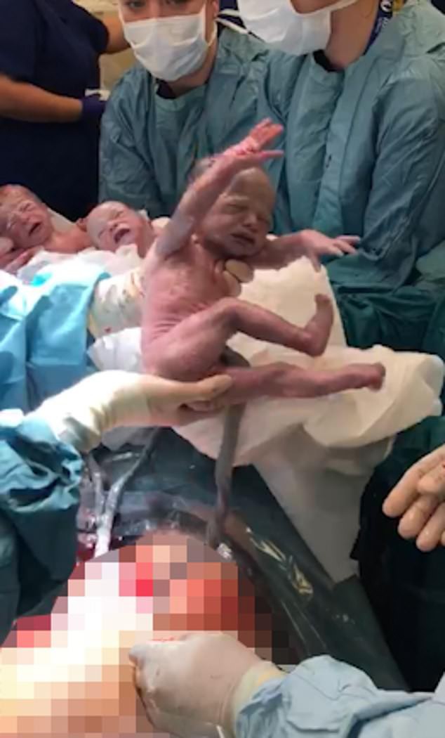 Dù đã được báo trước nhưng bà mẹ vẫn không thể tin vào mắt mình khi bác sĩ đón một đàn con trong bụng cô chào đời - Ảnh 5.