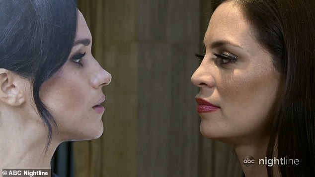 Chi gần 1 tỷ đồng để phẫu thuật giống công nương Meghan Markle, hai người phụ nữ nhận được kết quả bất ngờ - Ảnh 5. Chi gần 1 tỷ đồng để phẫu thuật giống công nương Meghan Markle, hai người phụ nữ nhận được kết quả bất ngờ - Ảnh 5.