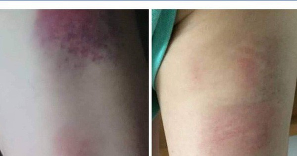Cuộc điện thoại khiến phụ huynh bức xúc của cô chủ nhiệm bị tố đánh 22 học sinh - Ảnh 1. Cuộc điện thoại khiến phụ huynh bức xúc của cô chủ nhiệm bị tố đánh 22 học sinh - Ảnh 1.