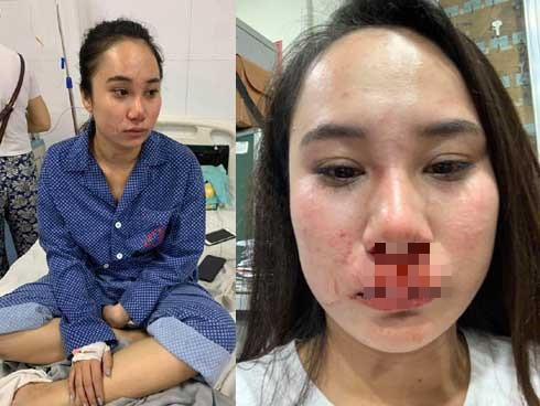 Luật sư của hot girl bị lột v&aacute;y h&agrave;nh hung: Nh&oacute;m người phụ nữ kh&ocirc;ng đưa ra được bằng chứng ngoại t&igrave;nh - Ảnh 1.