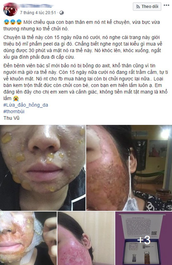 Không chỉ kem trộn, xu hướng tự peel da tại nhà cũng có thể khiến bạn hóa quỷ sau 1 lần sử dụng  - Ảnh 1.