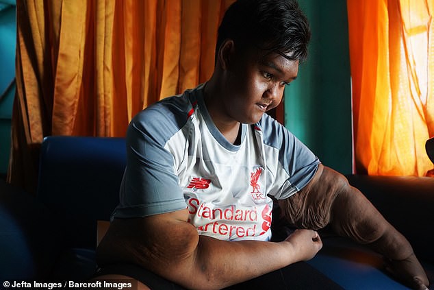 Từng được coi là ‘bé trai nặng nhất thế giới’, cậu bé Indonesia béo đến không thể đi học nổi giờ ra sao - Ảnh 10.