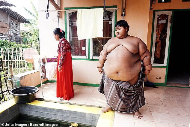 Từng được coi là ‘bé trai nặng nhất thế giới’, cậu bé Indonesia béo đến không thể đi học nổi giờ ra sao - Ảnh 2.