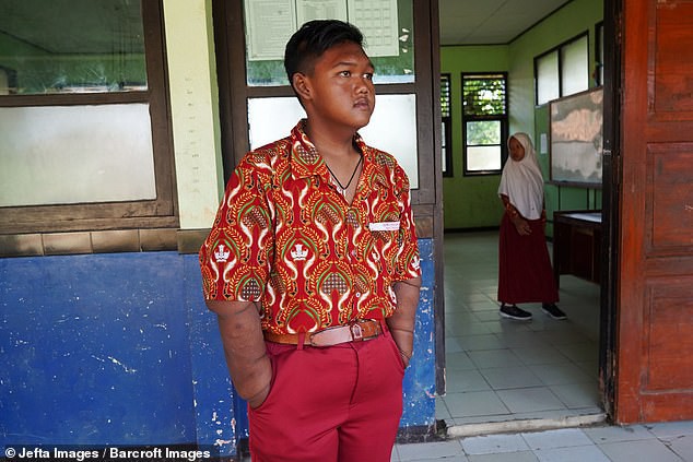 Từng được coi là ‘bé trai nặng nhất thế giới’, cậu bé Indonesia béo đến không thể đi học nổi giờ ra sao - Ảnh 5.