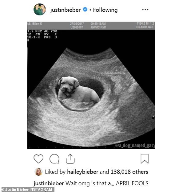 Justin Bieber khoe ảnh siêu âm của Hailey, tuyên bố lên chức cha sau 4 tháng kết hôn? - Ảnh 2.