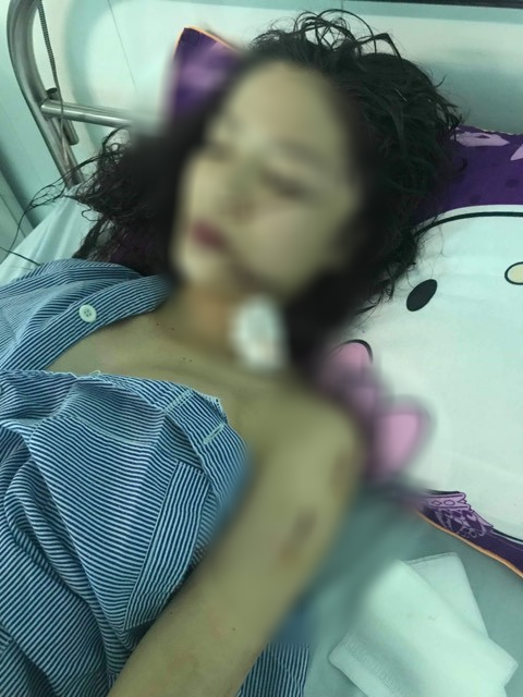 Chị ruột cô gái bị tấn công phải khâu 60 mũi: Mặt em tôi bị rạch như thế thì coi như hết đời người rồi - Ảnh 2.