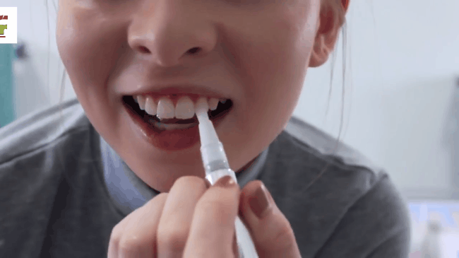 Chiếc bút diệu kỳ này đang khiến các chị em sục sôi tìm kiếm bởi công dụng làm trắng răng siêu hay  - Ảnh 3.