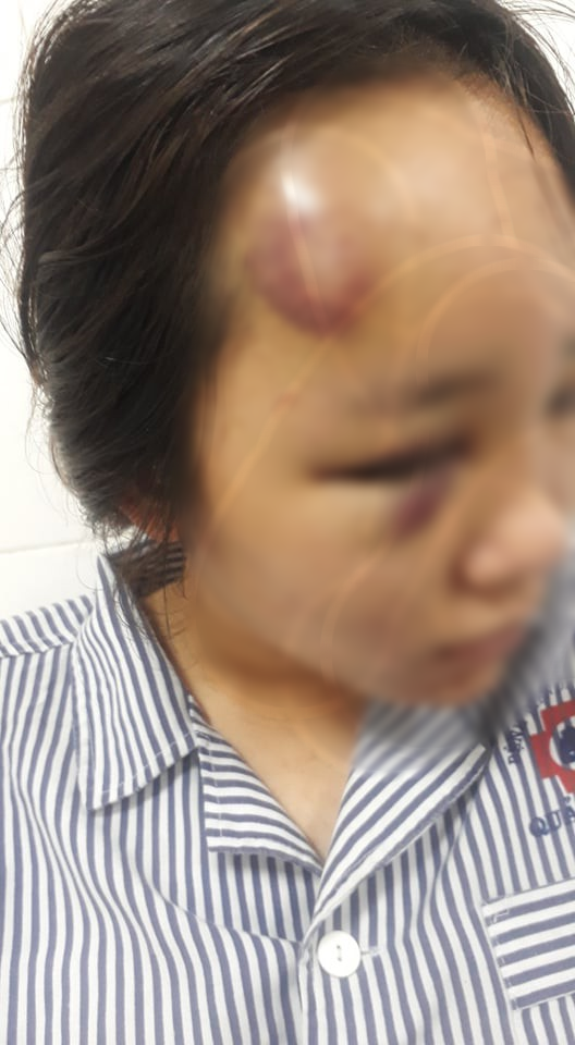 Nữ sinh ở Quảng Ninh nói lý do mình bị đánh nhập viện: Vì hẹn nhóm nữ sinh các trường khác để giải quyết mâu thuẫn trước đó - Ảnh 1.