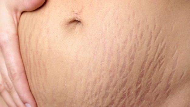 Kh&aacute;m ph&aacute; những b&iacute; mật &iacute;t ai biết đến của mỡ trăn - Ảnh 3.
