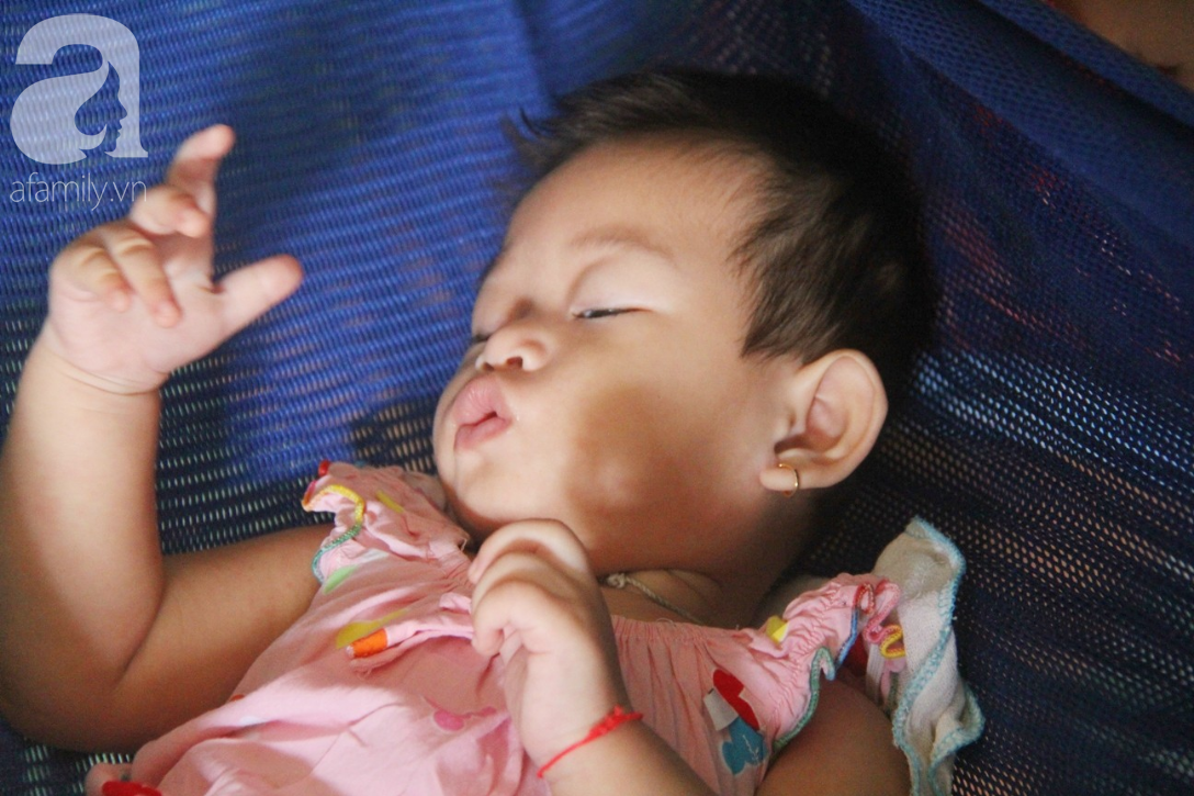 Bé gái 1 tuổi co giật liên tục đến mức méo miệng, bố mẹ nghèo bật khóc khi đã có tiền chữa bệnh cho con - Ảnh 2.