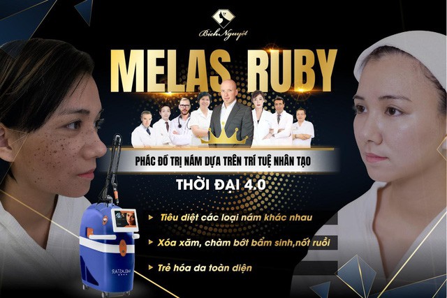 Hàng nghìn khách hàng trị nám thành công với “phác đồ Melas Ruby” - Ảnh 3. Hàng nghìn khách hàng trị nám thành công với “phác đồ Melas Ruby” - Ảnh 3.