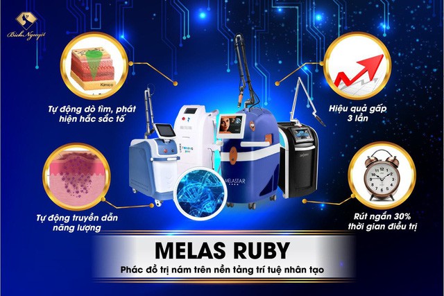 Hàng nghìn khách hàng trị nám thành công với “phác đồ Melas Ruby” - Ảnh 4. Hàng nghìn khách hàng trị nám thành công với “phác đồ Melas Ruby” - Ảnh 4.