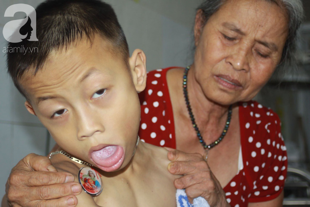 Xót cảnh bố mẹ bị khuyết tật, bé trai 10 tuổi bại não sống cạnh bà nội già yếu, cơm ngày ba bữa không đủ no - Ảnh 2.