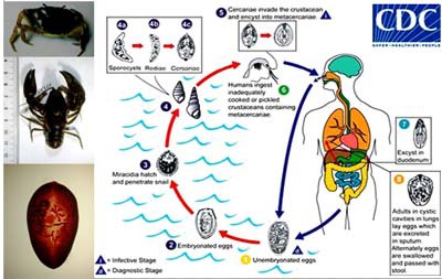 Từng có nhiều người được chẩn đoán bị nhiễm sán lá phổi do ăn tôm hùm đất  - Ảnh 6.