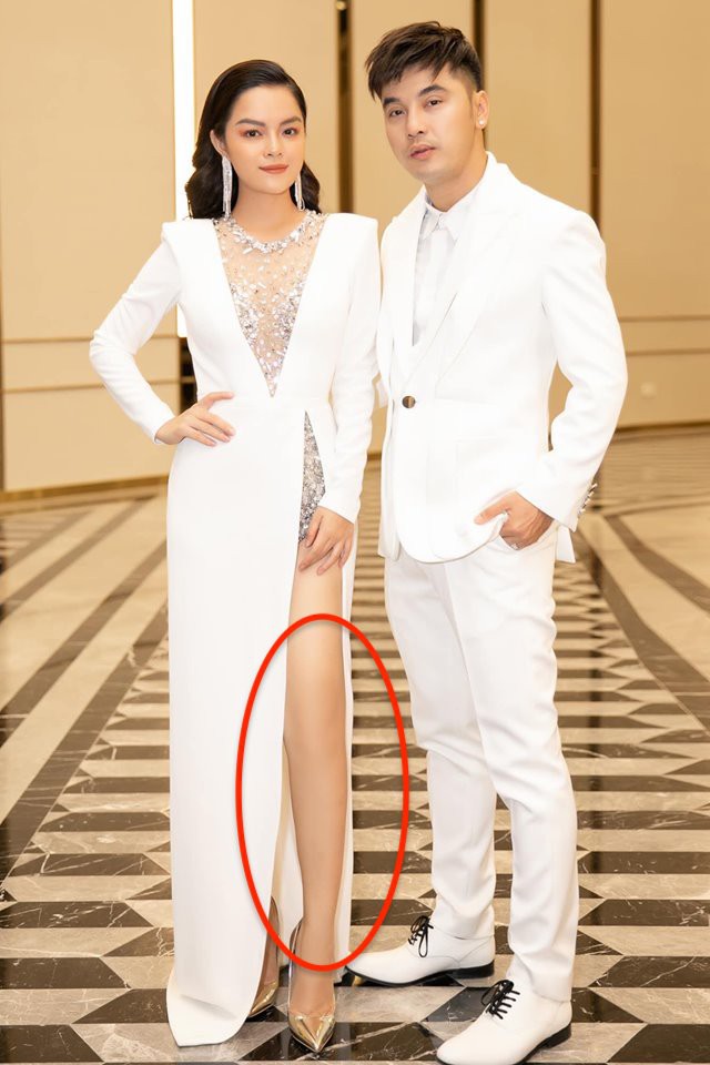 Di chứng của Photoshop tiếp tục gọi tên Phạm Quỳnh Anh:  Đôi chân cong vẹo bất thường, nuột nà như mất đầu gối  - Ảnh 1.