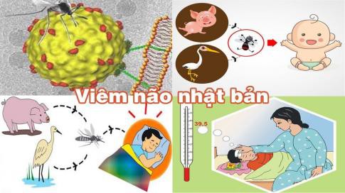 Đã có 1 trường hợp trẻ mắc viêm não Nhật Bản tại Hà Nội: Bệnh viêm não Nhật Bản có lây không và những ai dễ mắc bệnh? - Ảnh 2.