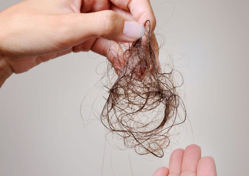 Chuyên gia chỉ mặt những nguyên nhân khiến tóc rụng nhiều không ngờ - Ảnh 4.